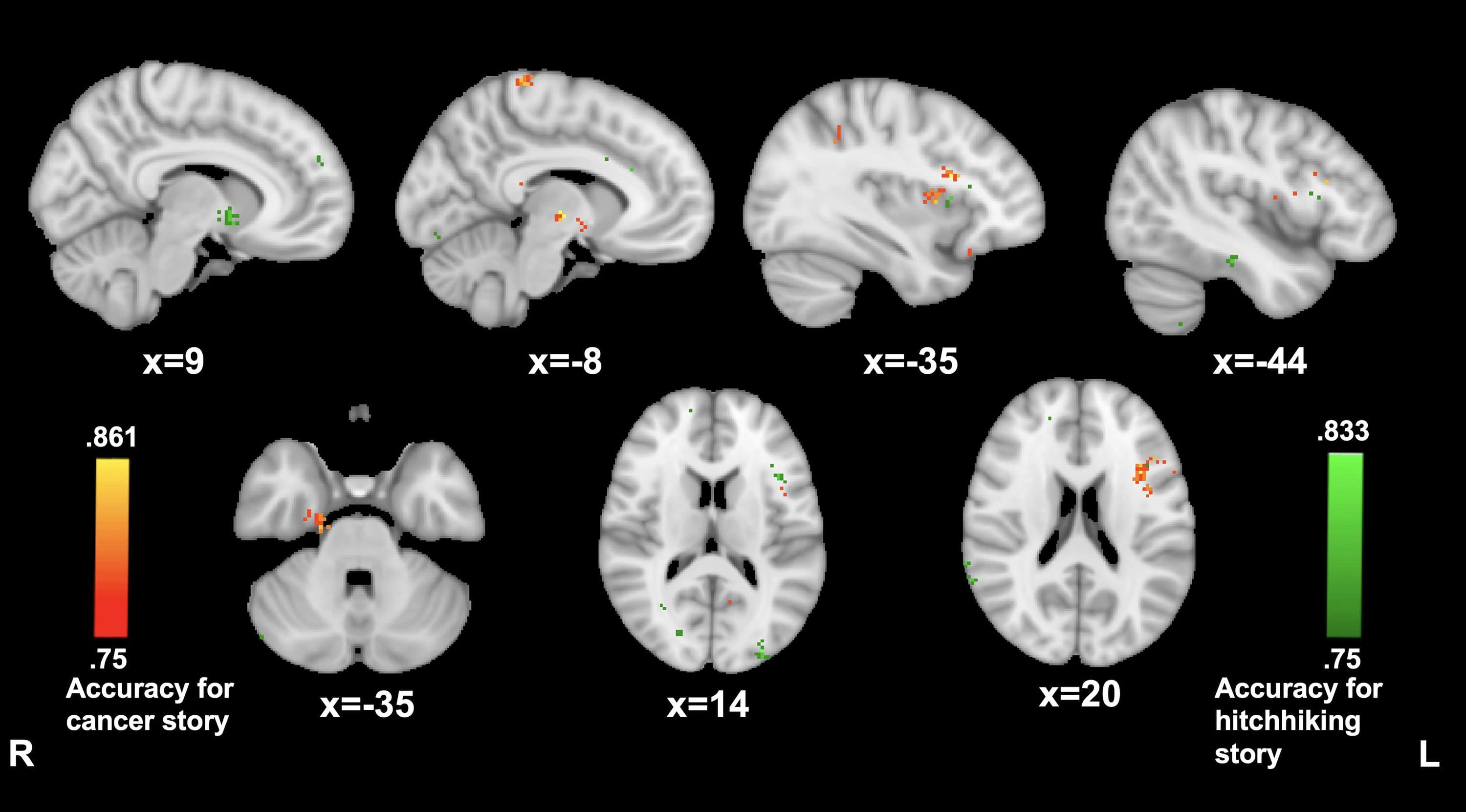 Frontiers  Functional Brain Connectivity During Narrative