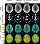 Frontiers | Real-Time Multifrequency MR Elastography of the Human Brain ...