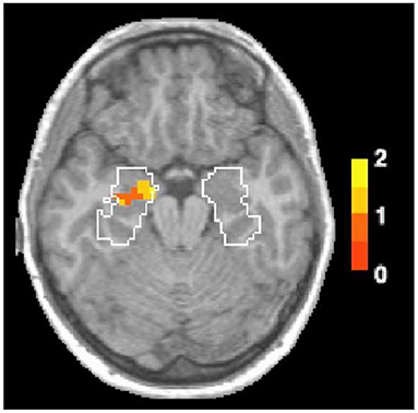 图1 -功能磁共振成像扫描显示大脑活动的差异odor-linked和picture-linked记忆。