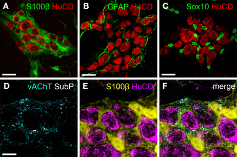 (a,c) maximum projection of colonic myenteric ganglia of mice