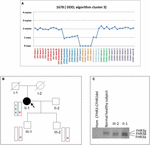 Frontiers Cfh And Cfhr Structural Variants In Atypical Hemolytic