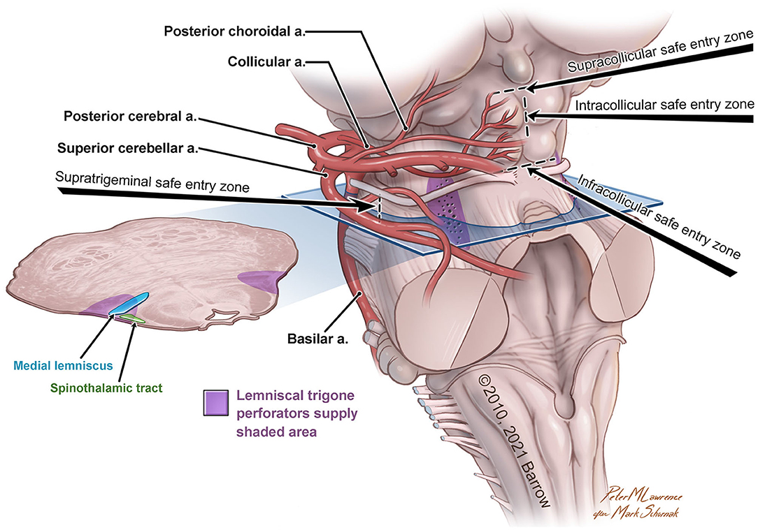 superior cerebellar artery distribution