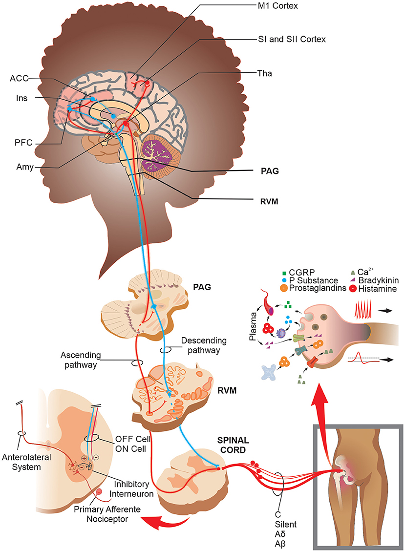 Frontiers Sickle Cell Disease Chronic Joint Pain Clinical Assessment 