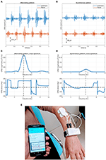 Frontiers | Wearable Devices For Assessment Of Tremor | Neurology