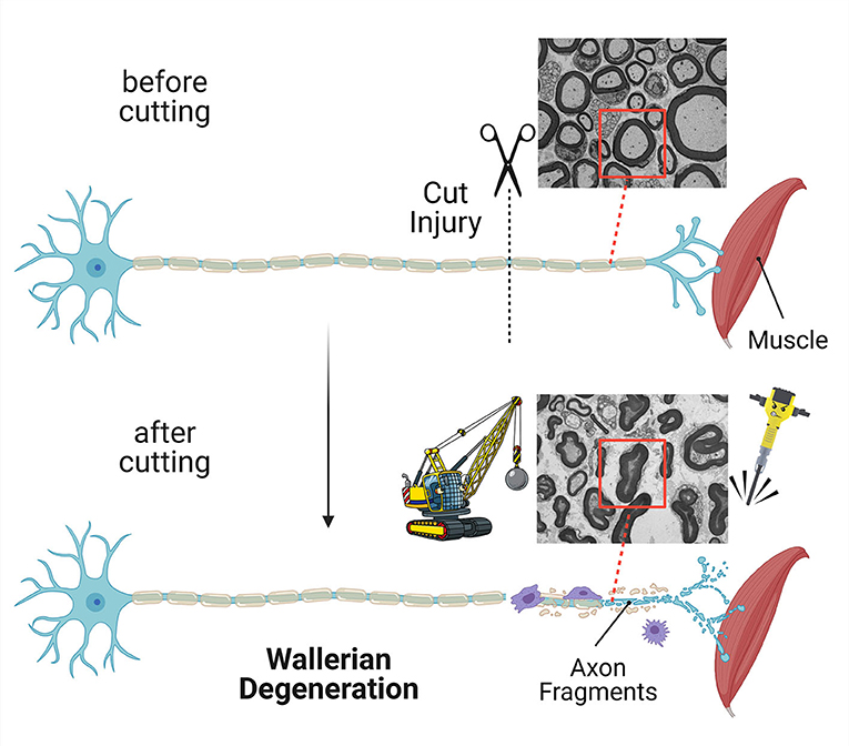 图2——如果一个轴突减少,部分分离神经元胞体迅速摧毁这一过程被称为沃勒变性。