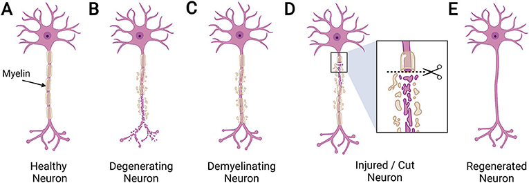 图2 - (A)成年人大脑中正常、健康的髓鞘神经元。