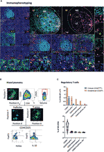 Frontiers | In Situ Characterization of Human Lymphoid Tissue Immune ...