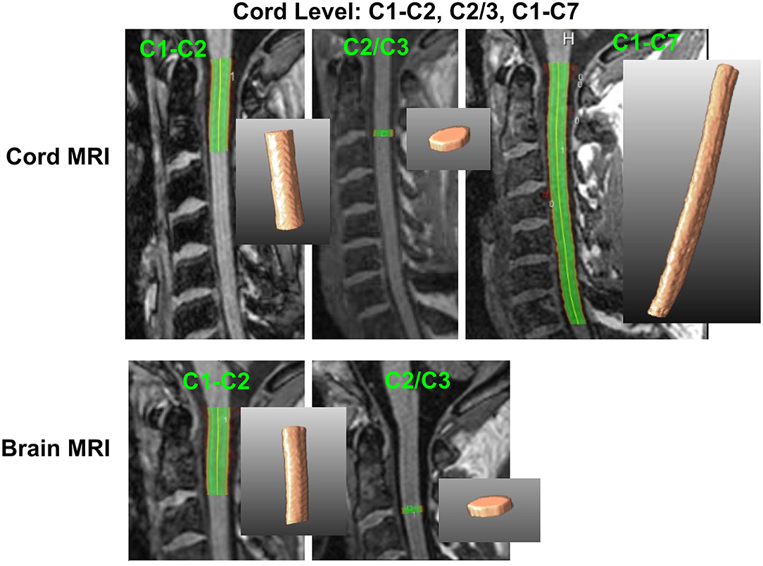 spinal cord cross section cervical