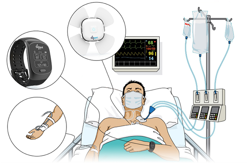 Frontiers A Pilot Study Of Blood Pressure Monitoring After Cardiac 