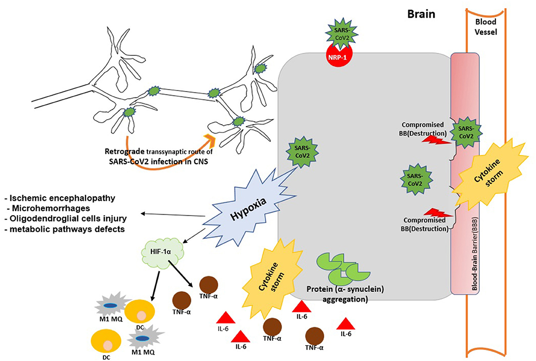 Frontiers The Immunopathogenesis Of Neuroinvasive Lesions Of Sars Cov