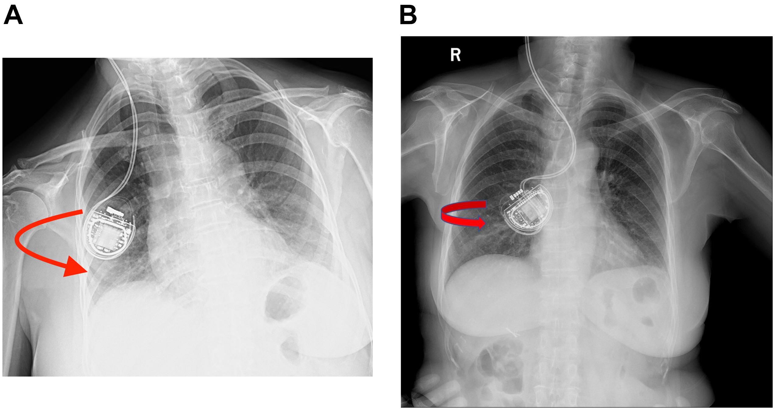 Pin by JW on Anatomy-Ribcage