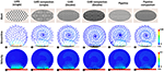 Frontiers | Computational Study of Hemodynamic Changes Induced by ...