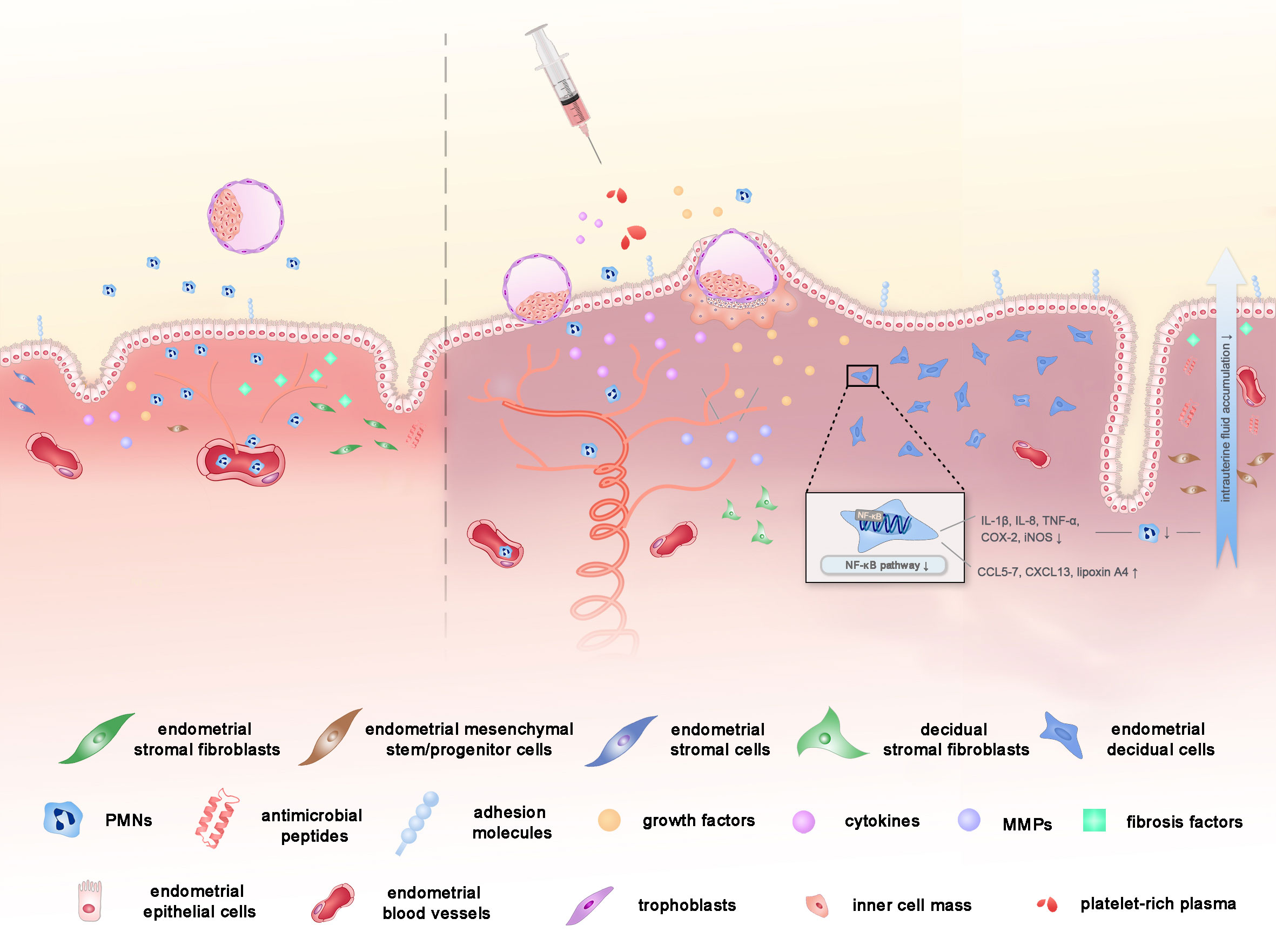 Frontiers Platelet Rich Plasma As A Potential New Strategy In The 