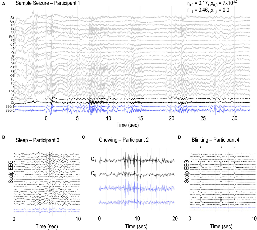 Frontiers  Seizure Diaries and Forecasting With Wearables: Epilepsy  Monitoring Outside the Clinic
