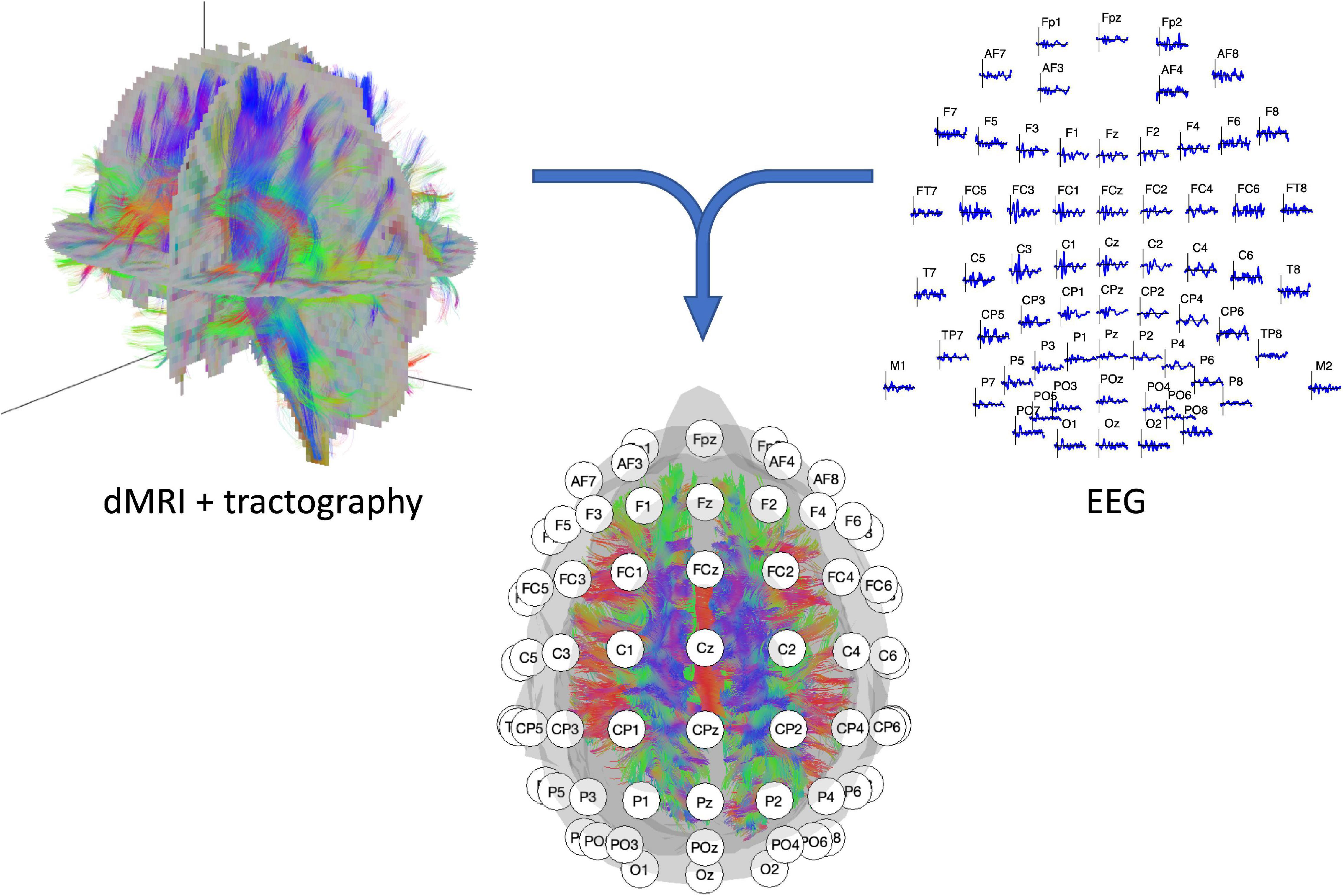 opdragelse det tvivler jeg på Sanders Frontiers | Brain Structural and Functional Connectivity: A Review of  Combined Works of Diffusion Magnetic Resonance Imaging and  Electro-Encephalography | Human Neuroscience