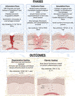 Frontiers | Mobilizing Endogenous Repair Through Understanding Immune ...