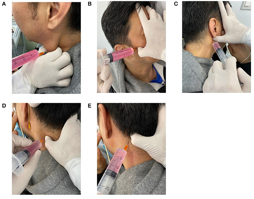 Frontiers  Latent Myofascial Trigger Points Injection Reduced the Severity  of Persistent, Moderate to Severe Allergic Rhinitis: A Randomized  Controlled Trial