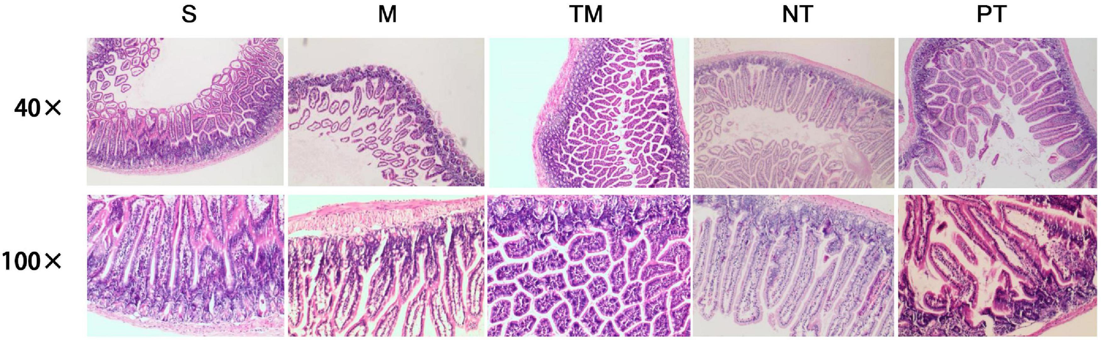 Frontiers | Physical Exercise Repairs Obstructive Jaundice-Induced ...