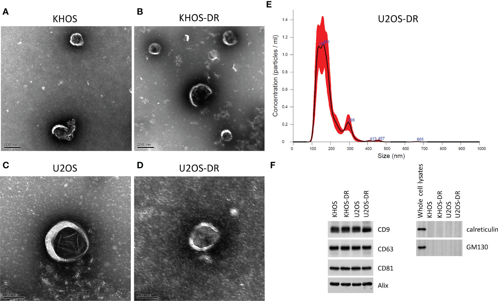 Frontiers | Exosomal Long Non-Coding RNA ANCR Mediates Drug