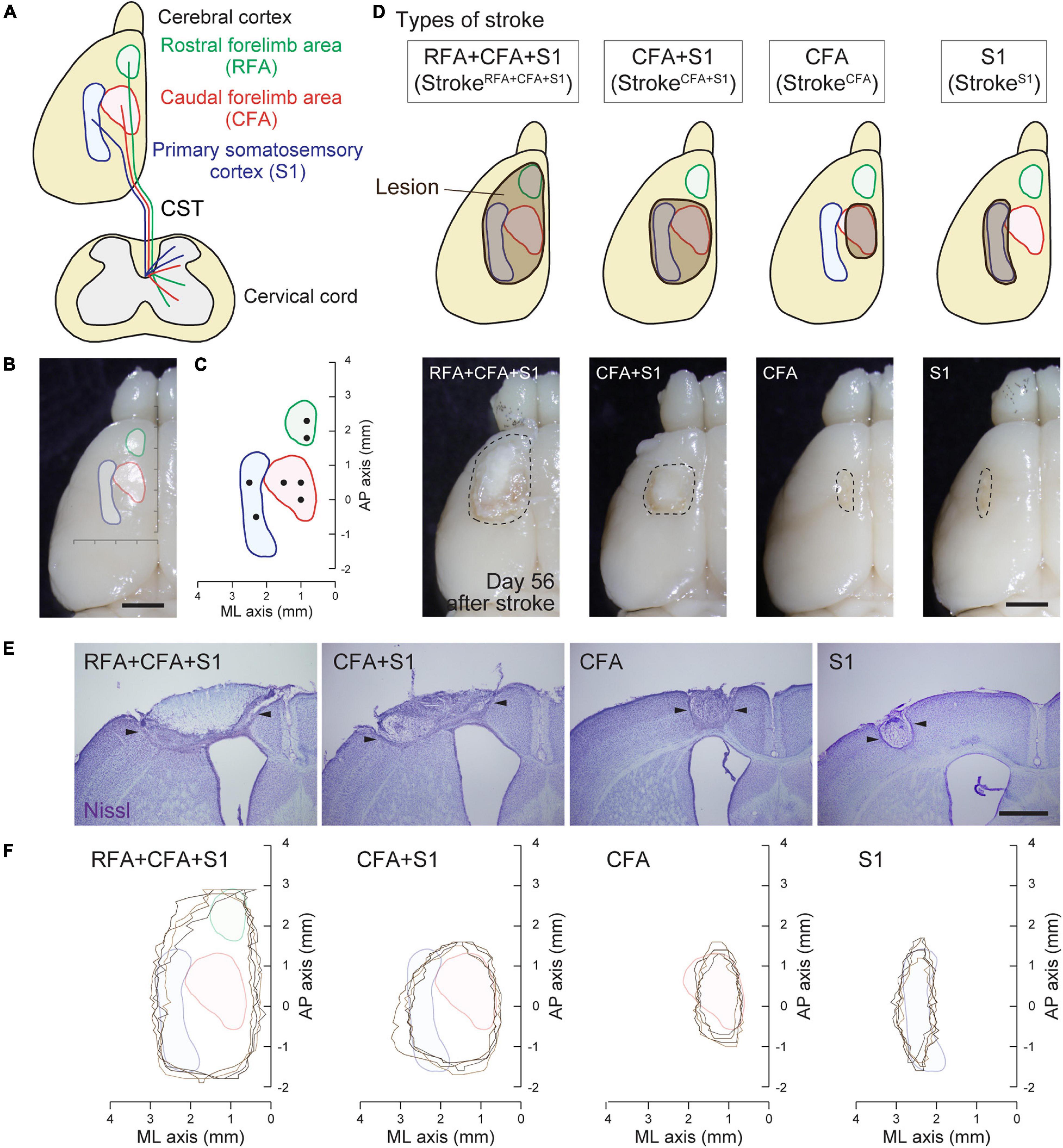 Frontiers Lesion Area In The Cerebral Cortex Determines The Patterns 