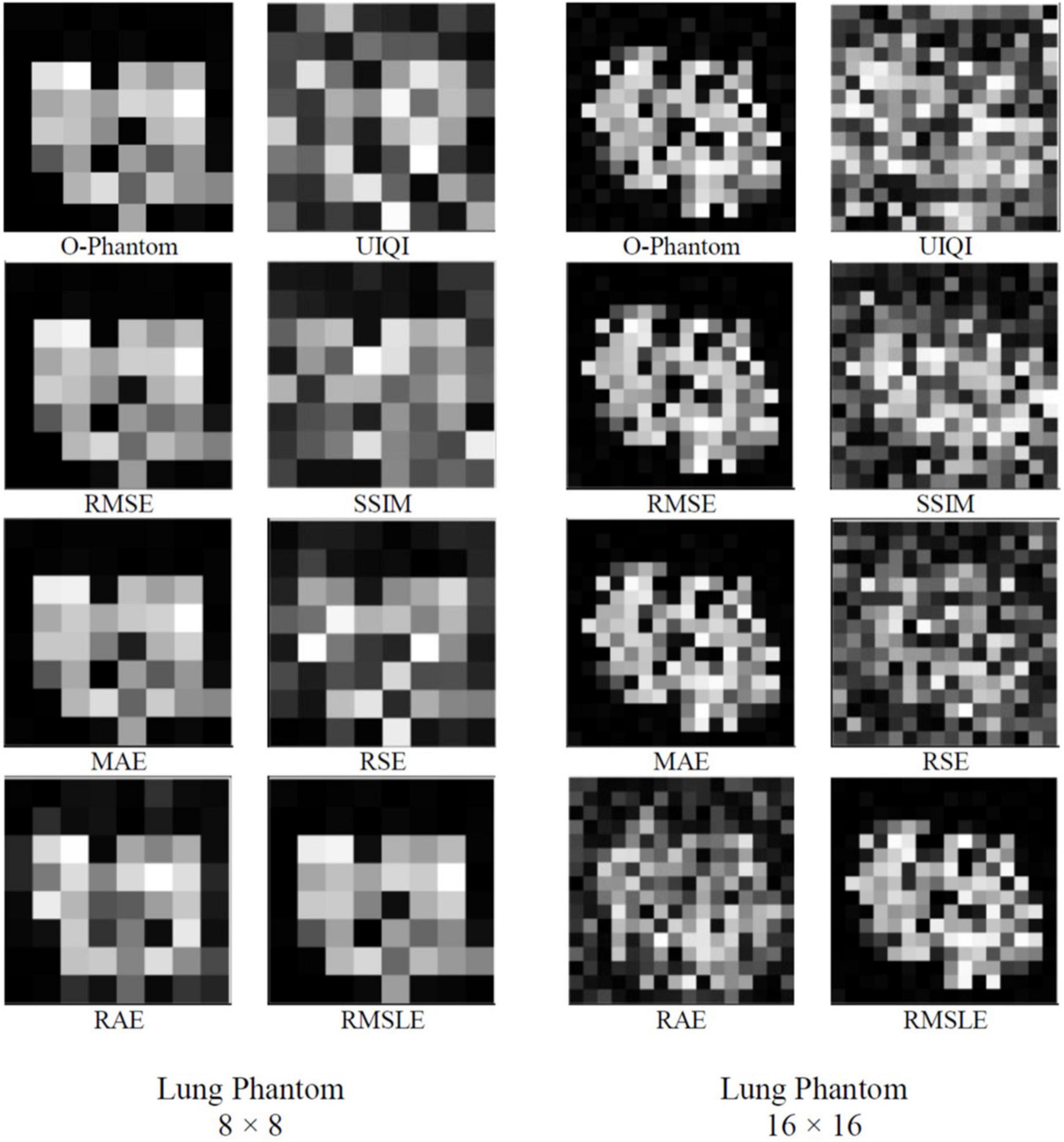 Frontiers Simulated Annealing Based Image Reconstruction For Patients With Covid 19 As A Model For Ultralow Dose Computed Tomography Physiology