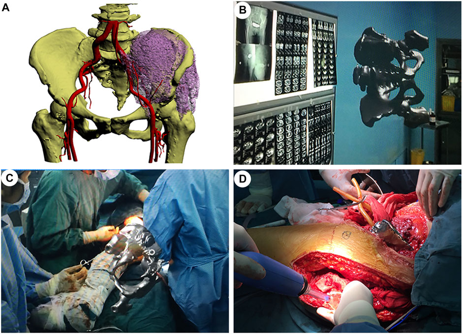 A real-time dynamic 3D model of the human inguinal region for surgical  education