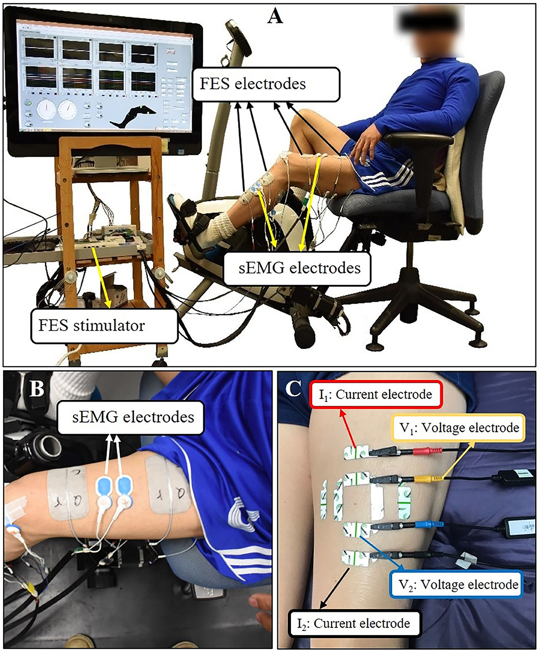 Modified neuromuscular electrical stimulation system can track the