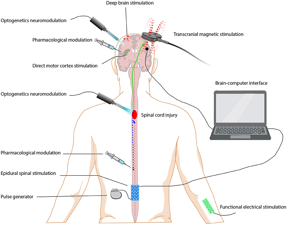 Effects of neuromuscular electrical stimulation and voluntary commands on  the spinal reflex excitability of remote limb muscles