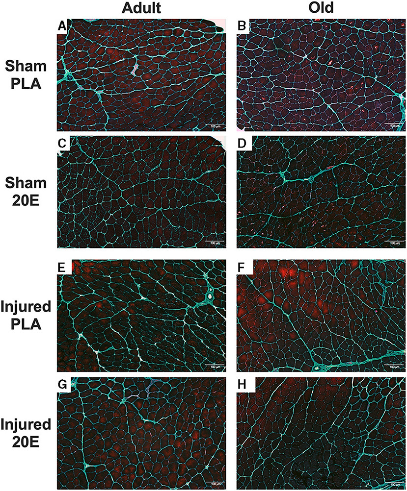 Improved recovery from skeletal muscle damage is largely unexplained by  myofibrillar protein synthesis or inflammatory and regenerative gene  expression pathways