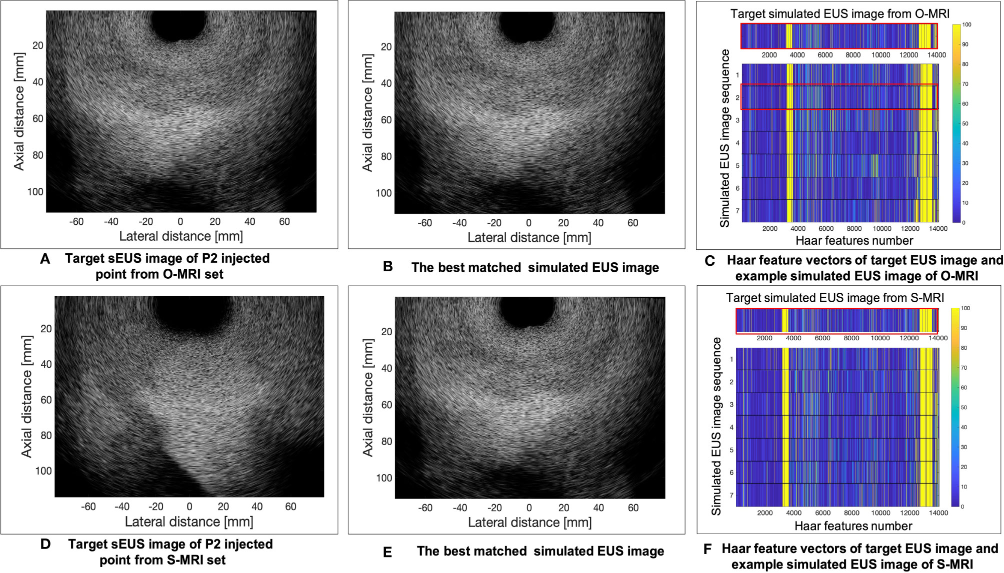 Frontiers | The Feasibility of Haar Feature-Based Endoscopic Ultrasound ...