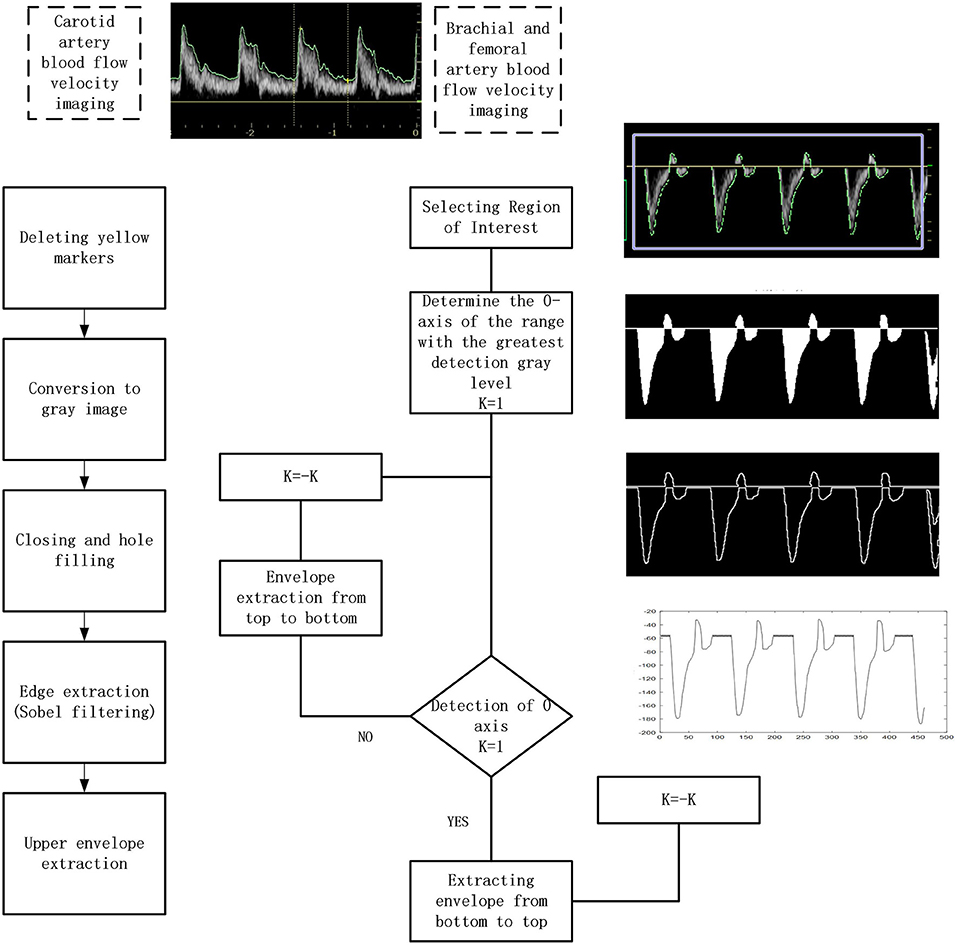 Raw data traces show venous blood velocity, mean arterial pressure