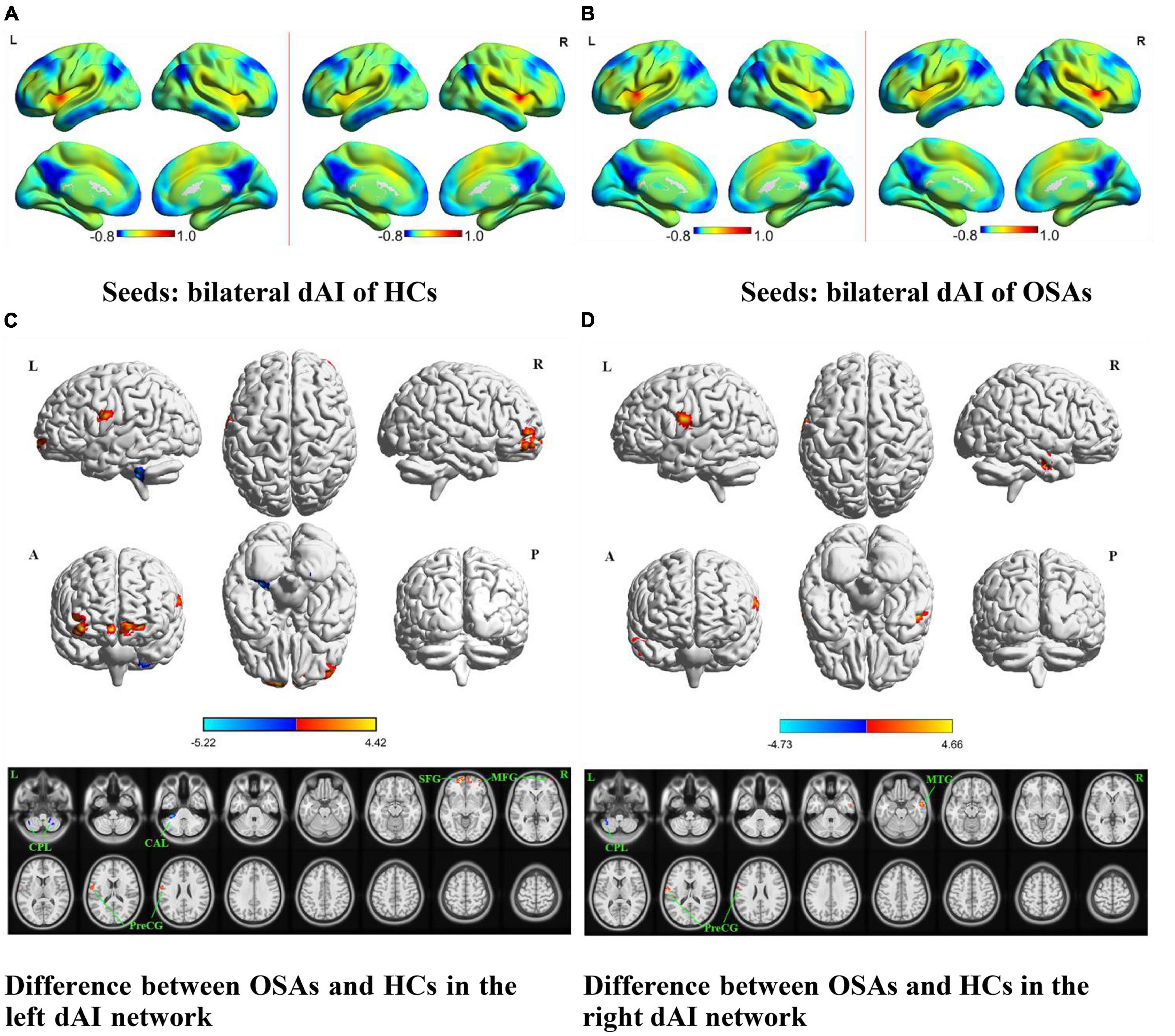 Large-scale functional brain networks in human non-rapid eye movement  sleep: insights from combined electroencephalographic/functional magnetic  resonance imaging studies