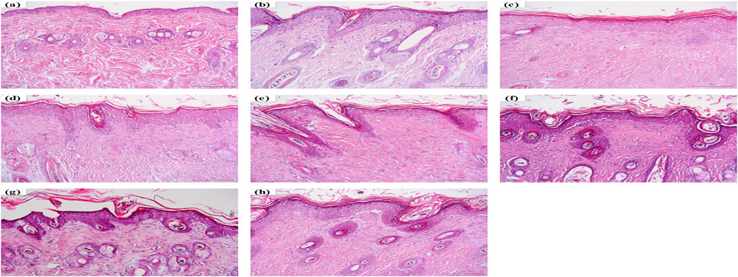 Frontiers | Study on the Molecular Basis of Huanglian Jiedu Decoction ...