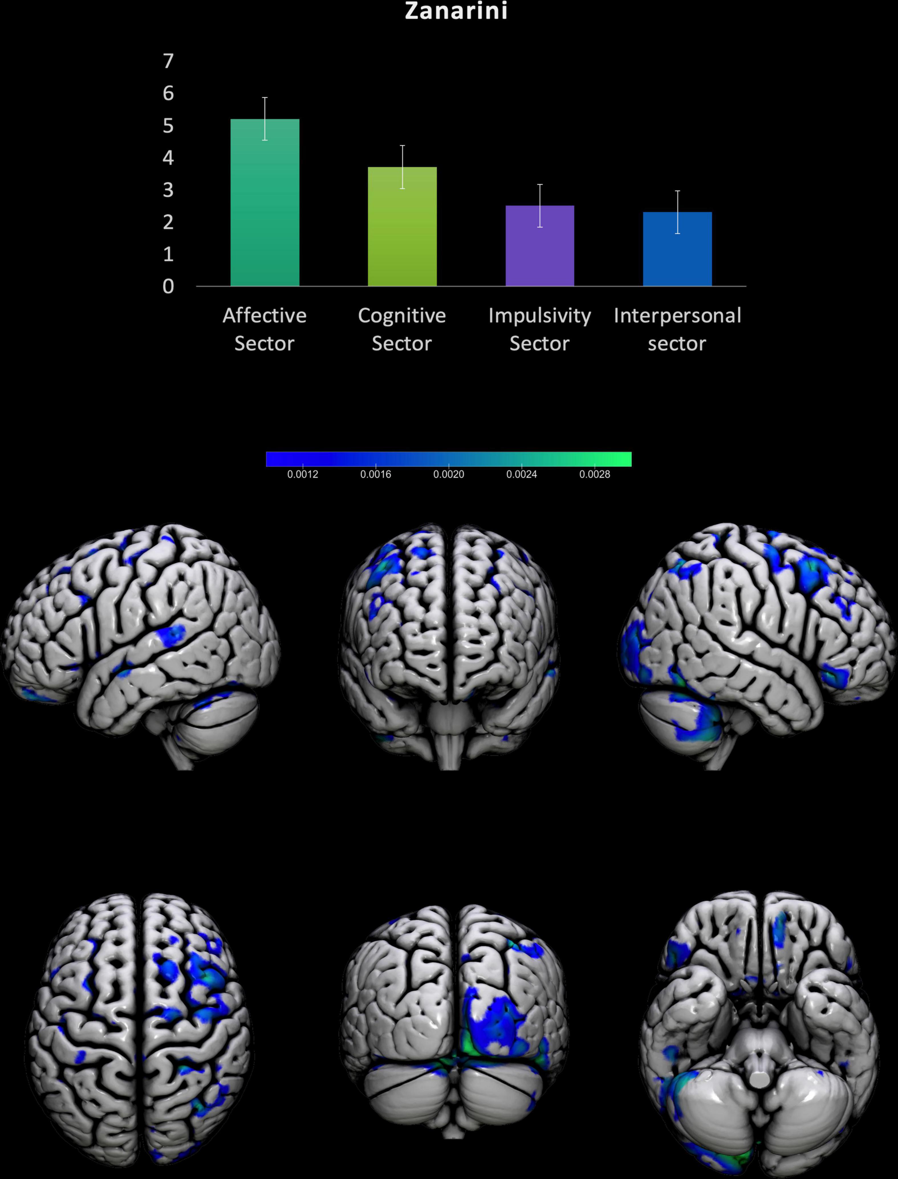 borderline personality disorder brain abnormalities
