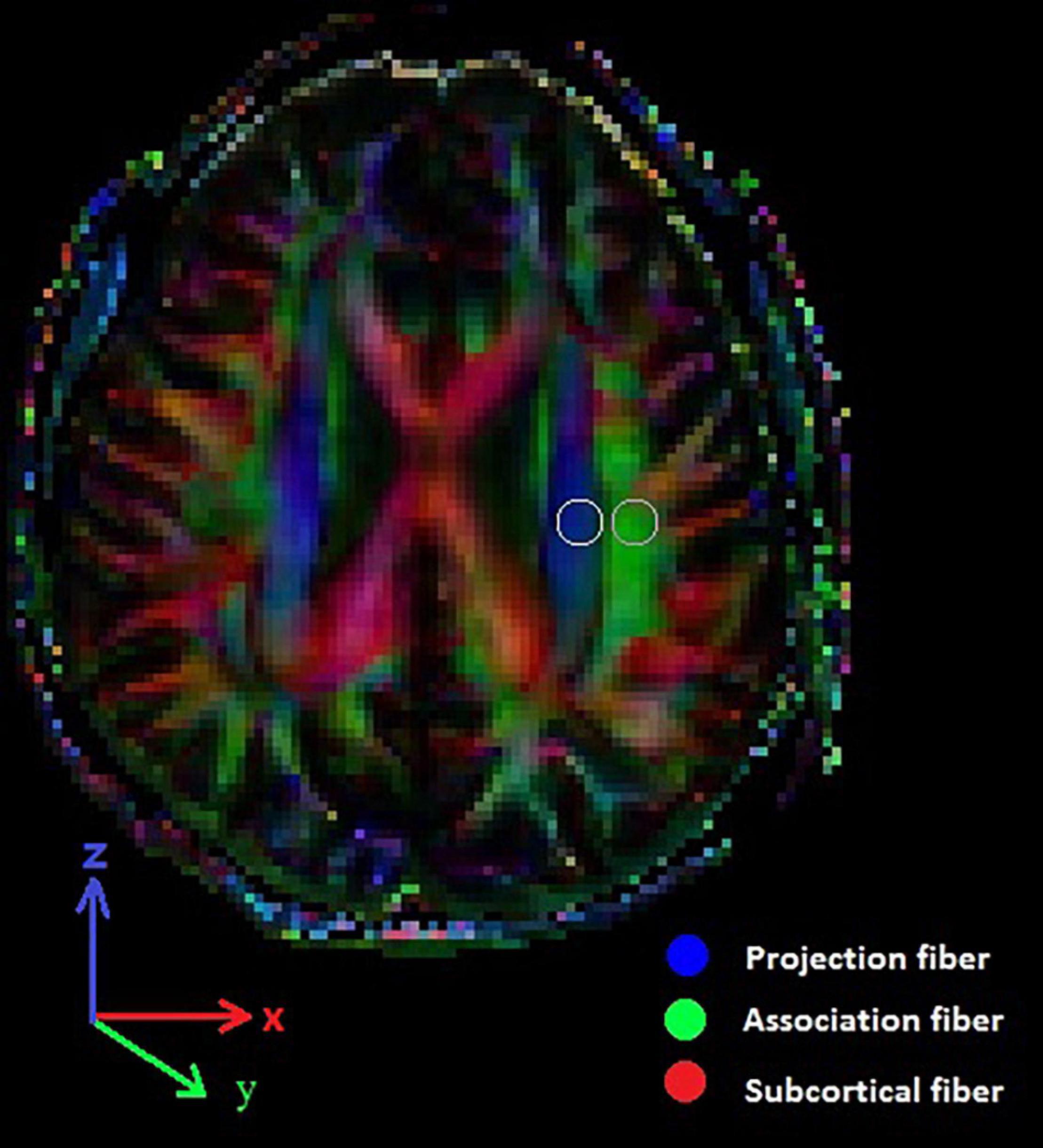 Frontiers | Diffusion Tensor Imaging Along the Perivascular Space 