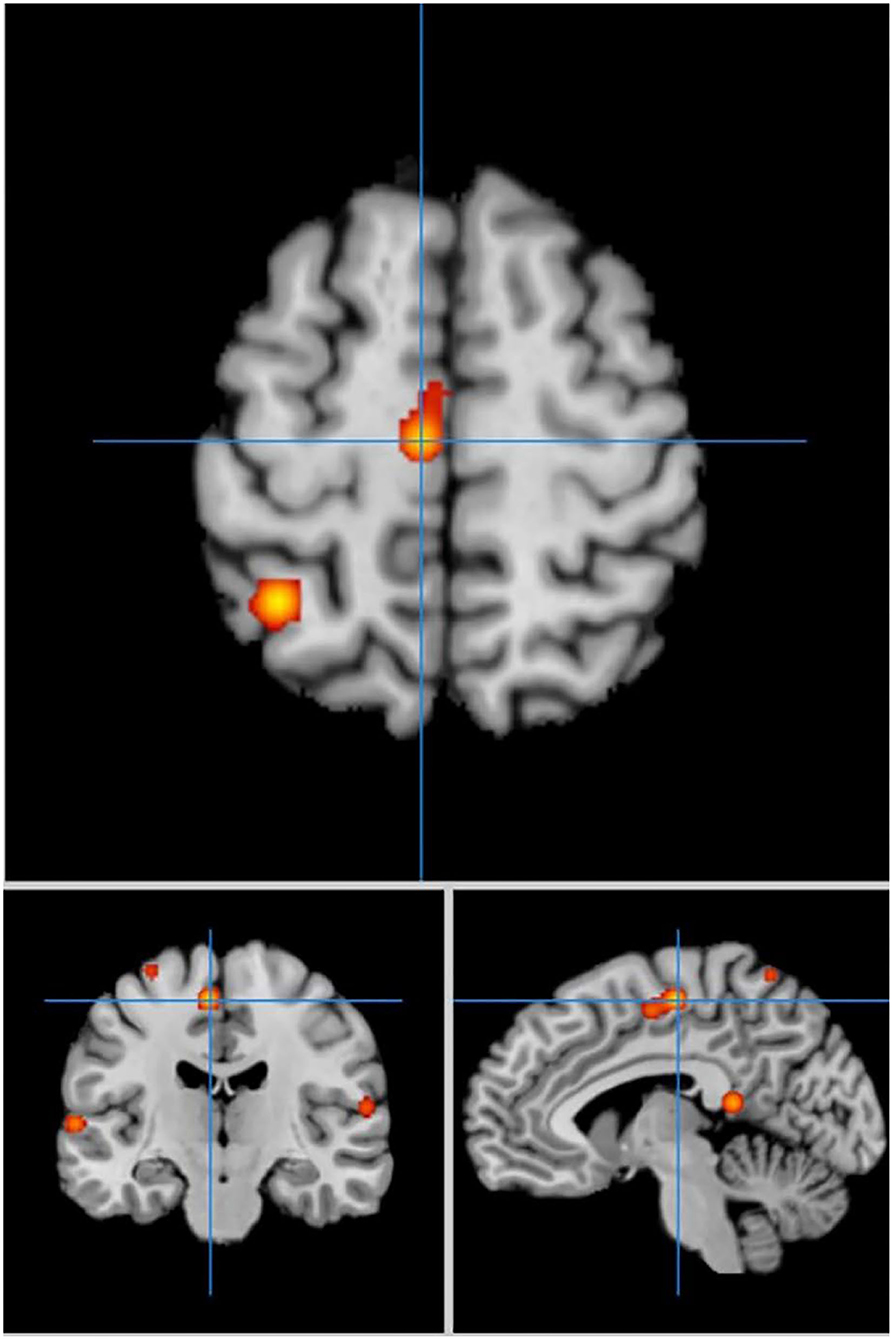Attentional focus modulates automatic finger-tapping movements