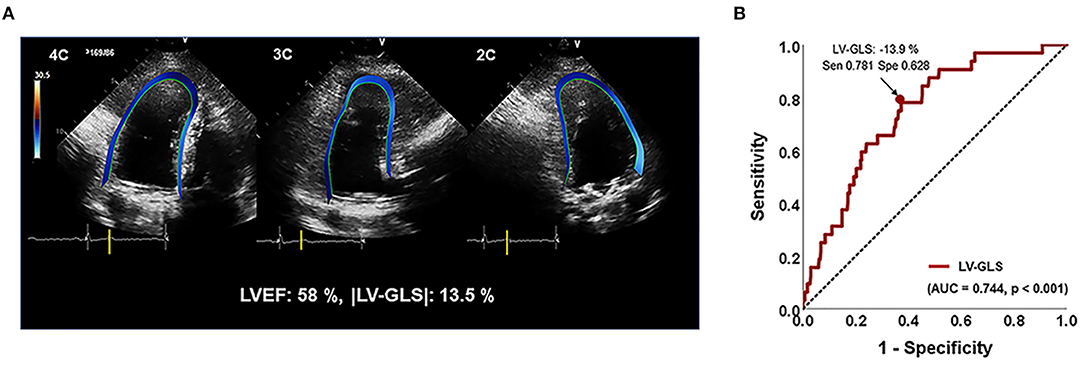 Impaired left ventricular global longitudinal strain is associated
