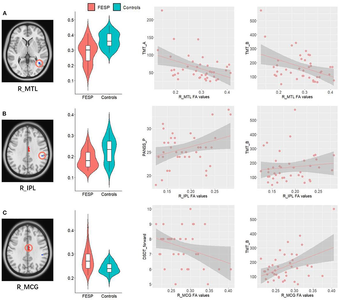 Frontiers Dna Methylation Basis In The Effect Of White Matter Integrity Deficits On Cognitive