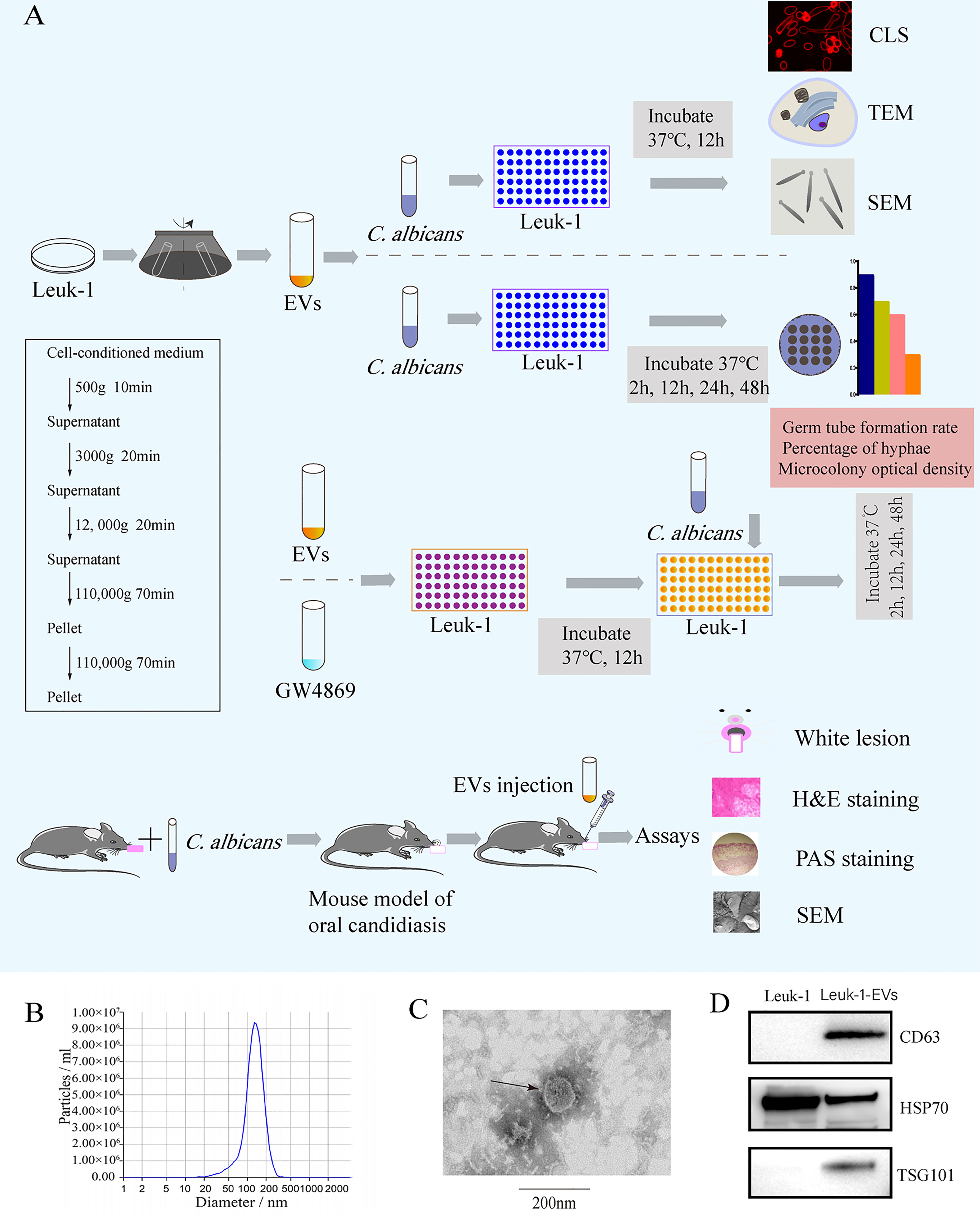 Frontiers | Antimicrobial Effect of Extracellular Vesicles Derived