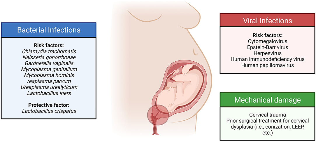 Treating Short Cervix (and Cervical Insufficiency) in Pregnancy