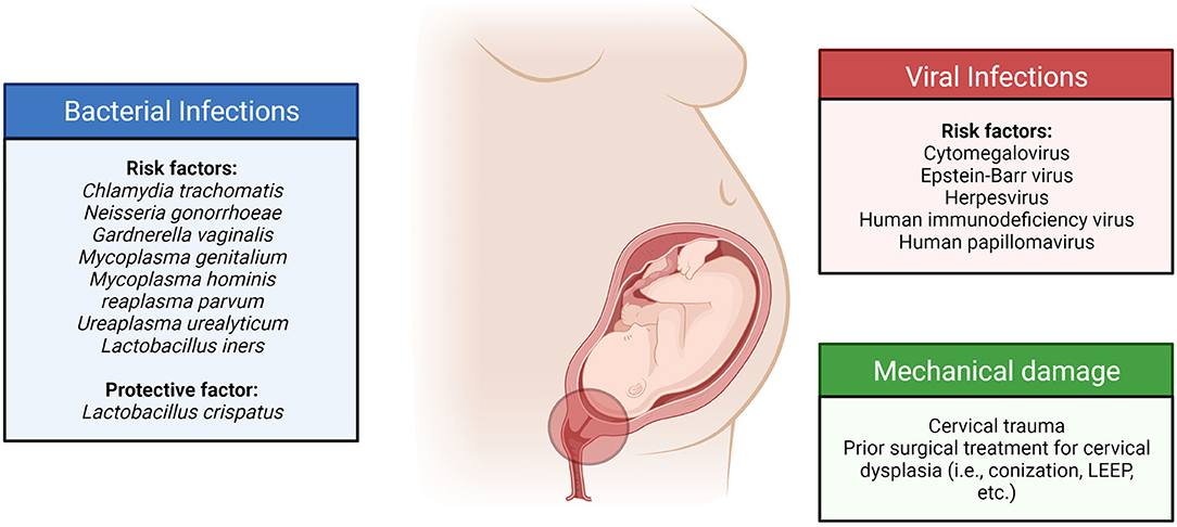 Frontiers Breaking Down The Barrier The Role Of Cervical Infection 