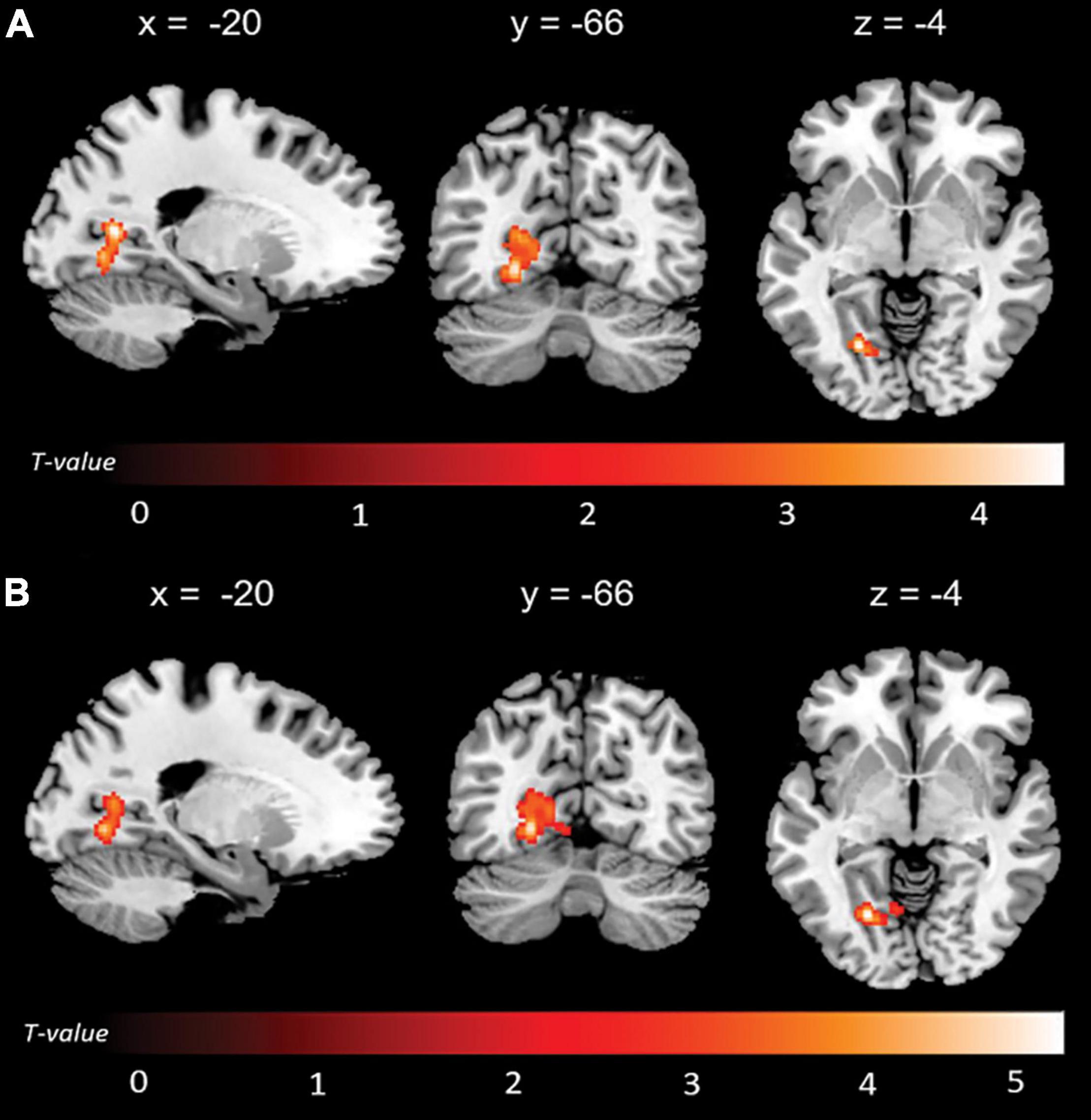 Frontiers | Altered Interplay Among Large-Scale Brain Functional 