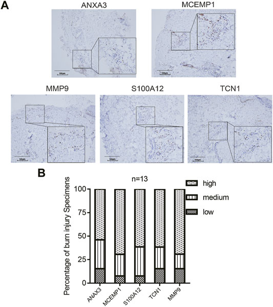 Frontiers  Identification and Verification of Five Potential Biomarkers  Related to Skin and Thermal Injury Using Weighted Gene Co-Expression  Network Analysis