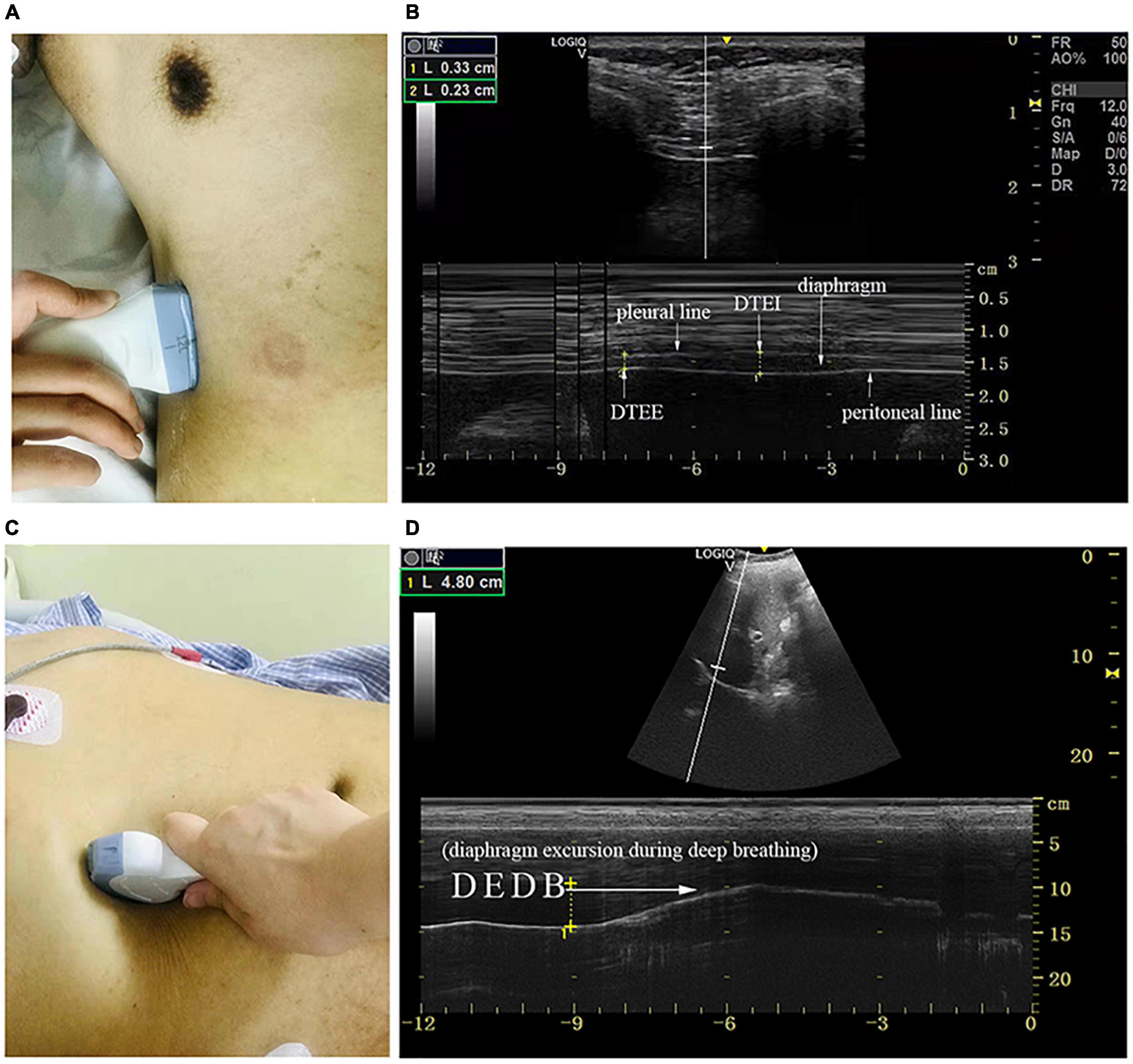 Frontiers | The Role of the Diaphragm in Postural Stability and