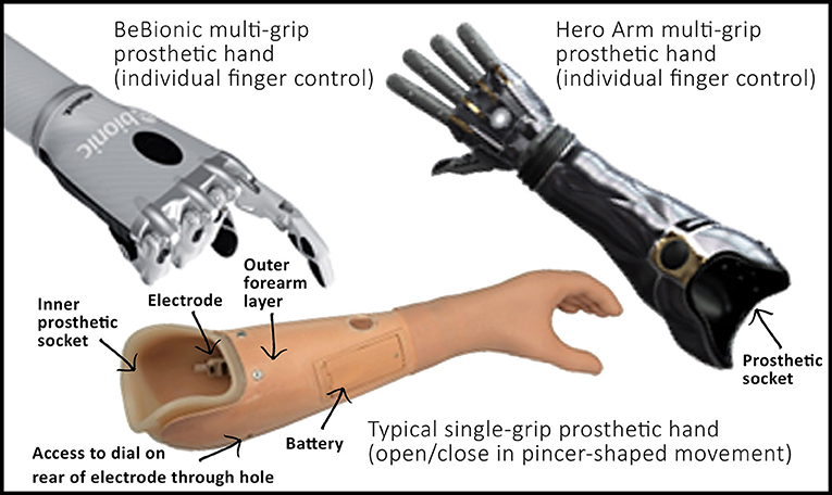 Why Does My Prosthetic Hand Not Always Do What It Is Told? · Frontiers for  Young Minds