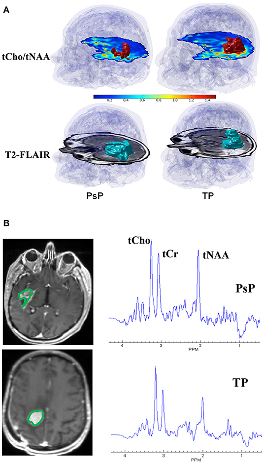 Frontiers Emerging MR Imaging and Spectroscopic Methods to Study