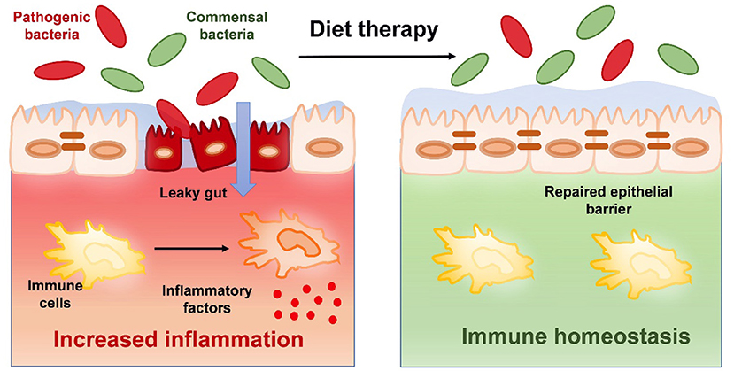 Frontiers  Nutraceuticals for the Treatment of IBD: Current Progress and  Future Directions