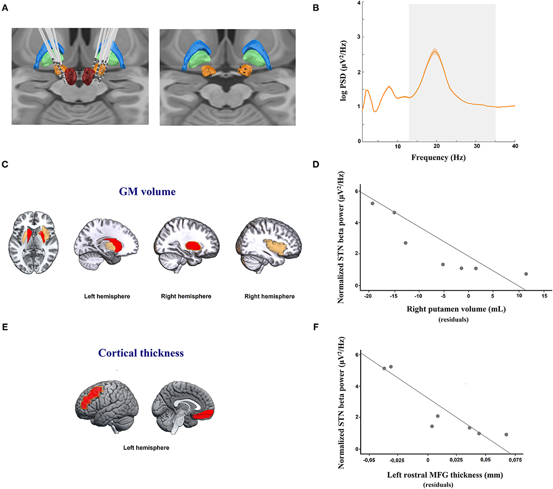 Frontiers  Stimulation of the Subthalamic Nucleus Changes