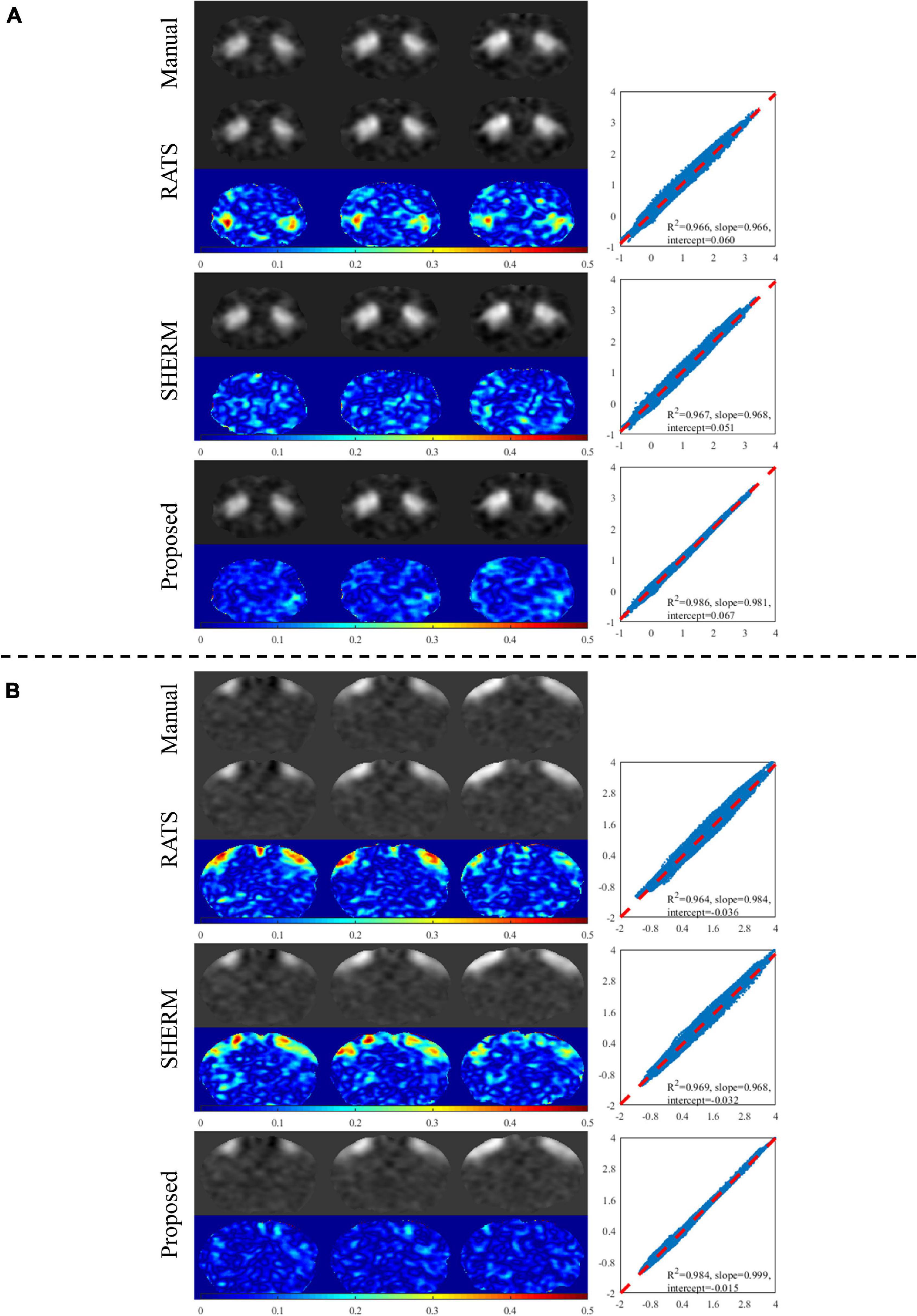 Frontiers  Automated Skull Stripping in Mouse Functional Magnetic  Resonance Imaging Analysis Using 3D U-Net