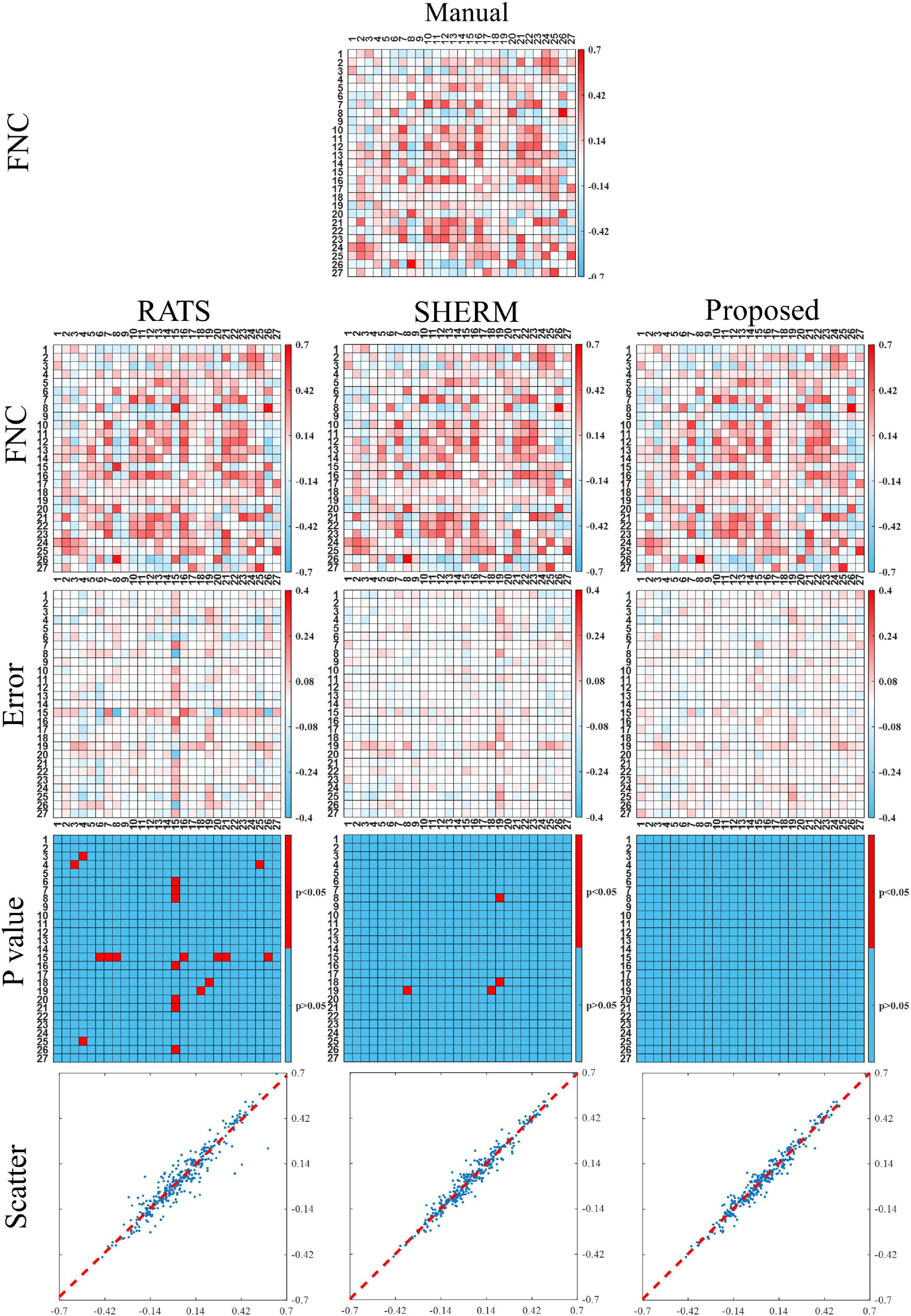 Frontiers  Automated Skull Stripping in Mouse Functional Magnetic  Resonance Imaging Analysis Using 3D U-Net